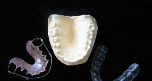 Ortodoncia Invisible: por qué es tendencia Ortodoncia Invisible