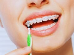 Soluciones estéticas y efectivas para corregir la sonrisa ortodoncia invisible